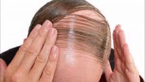 cabello-2